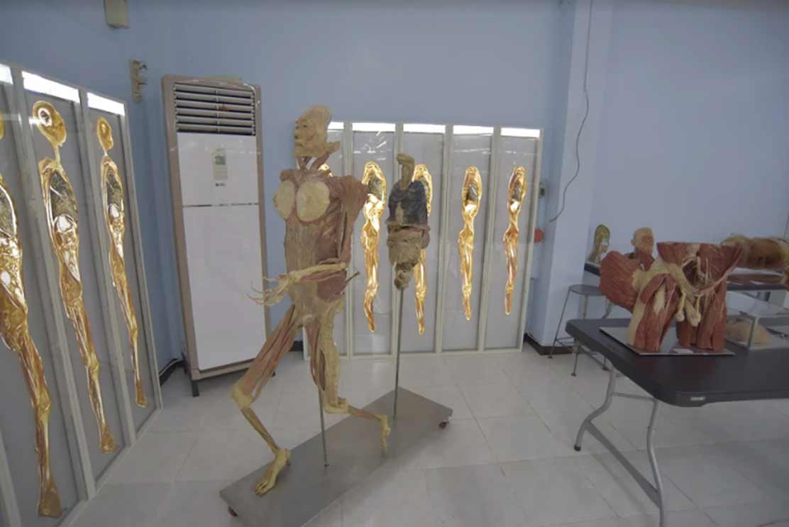 Plastinated Models