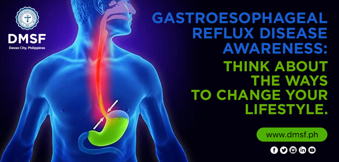 Gastroesophageal-Reflux-Disease-Awareness-Think-about-the-ways-to-change-your-lifestyle.php